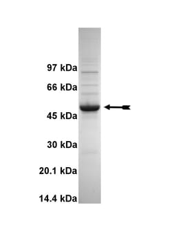 Eurofins DiscoverX EphB4 Protein, Active 10 &mu;g | Buy Online | Eurofins DiscoverX | Fisher Scientific